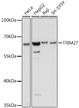Western blot - TRIM27 Polyclonal Antibody 