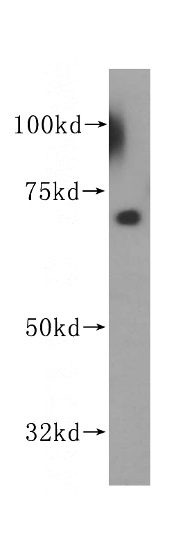HepG2 cells were subjected to SDS PAGE followed by western blot with Catalog No:113578(PAPSS1 antibody) at dilution of 1:500