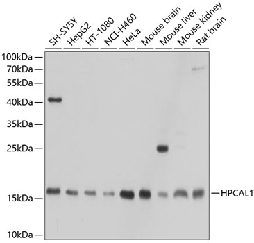Western blot - HPCAL1 Polyclonal Antibody 