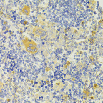 Immunohistochemistry - DPP3 Polyclonal Antibody 