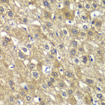 Immunohistochemistry - MYBPC2 Polyclonal Antibody 