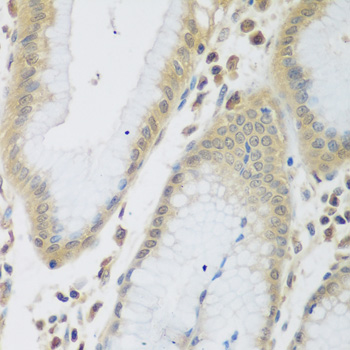 Immunohistochemistry - ENPEP Polyclonal Antibody 
