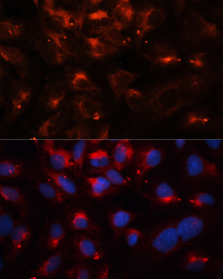 Immunofluorescence - CPT1B Polyclonal Antibody 
