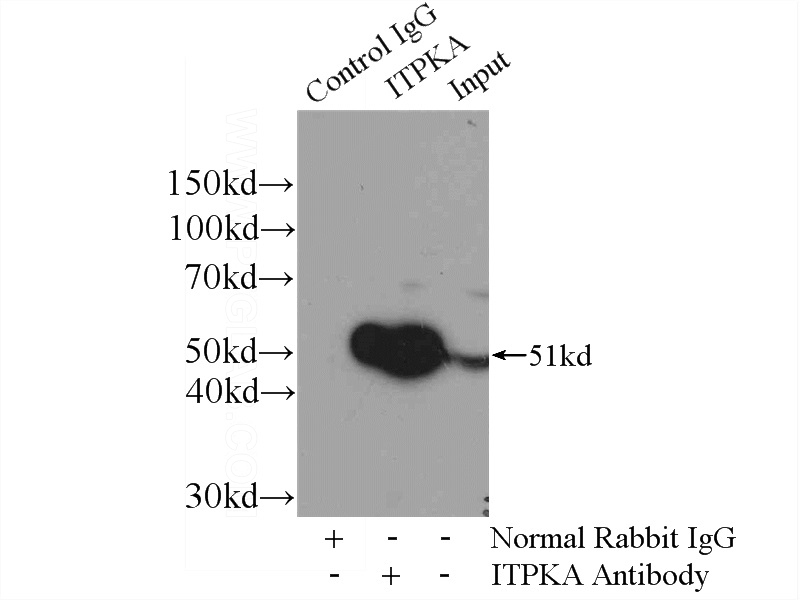 IP Result of anti-ITPKA (IP:Catalog No:111957, 4ug; Detection:Catalog No:111957 1:400) with mouse brain tissue lysate 4000ug.