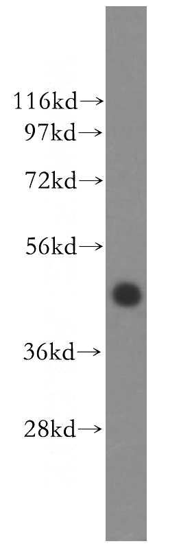 human brain tissue were subjected to SDS PAGE followed by western blot with Catalog No:116007(TFDP2 antibody) at dilution of 1:400