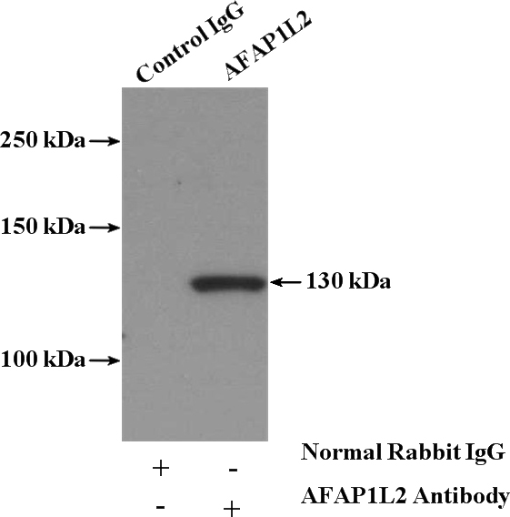 IP Result of anti-AFAP1L2 (IP:Catalog No:107904, 4ug; Detection:Catalog No:107904 1:500) with mouse thymus tissue lysate 2800ug.