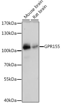 Western blot - GPR155 Polyclonal Antibody 