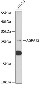 Western blot - AGPAT2 Polyclonal Antibody 