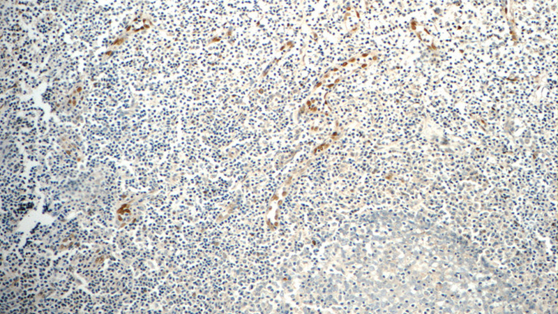 Immunohistochemistry of paraffin-embedded human tonsillitis tissue slide using Catalog No:111738(IL33 Antibody) at dilution of 1:50 (under 10x lens)