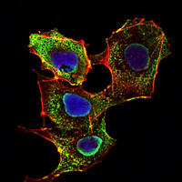 Immunofluorescence analysis of NIH/3T3 cells using SMAD3 mouse mAb (green). Blue