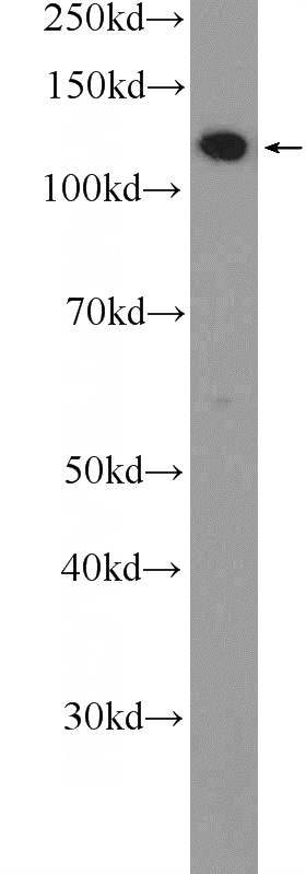 RAW 264.7 cells were subjected to SDS PAGE followed by western blot with Catalog No:112276(CD107a Antibody) at dilution of 1:2000