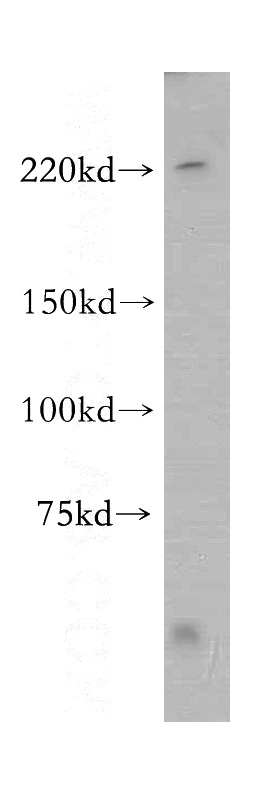 mouse brain tissue were subjected to SDS PAGE followed by western blot with Catalog No:115068(ZFYVE9 antibody) at dilution of 1:1000