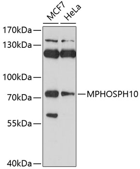 Western blot - MPHOSPH10 Polyclonal Antibody 