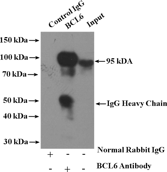 IP Result of anti-BCL6 (IP:Catalog No:117102, 4ug; Detection:Catalog No:117102 1:1000) with Raji cells lysate 1400ug.