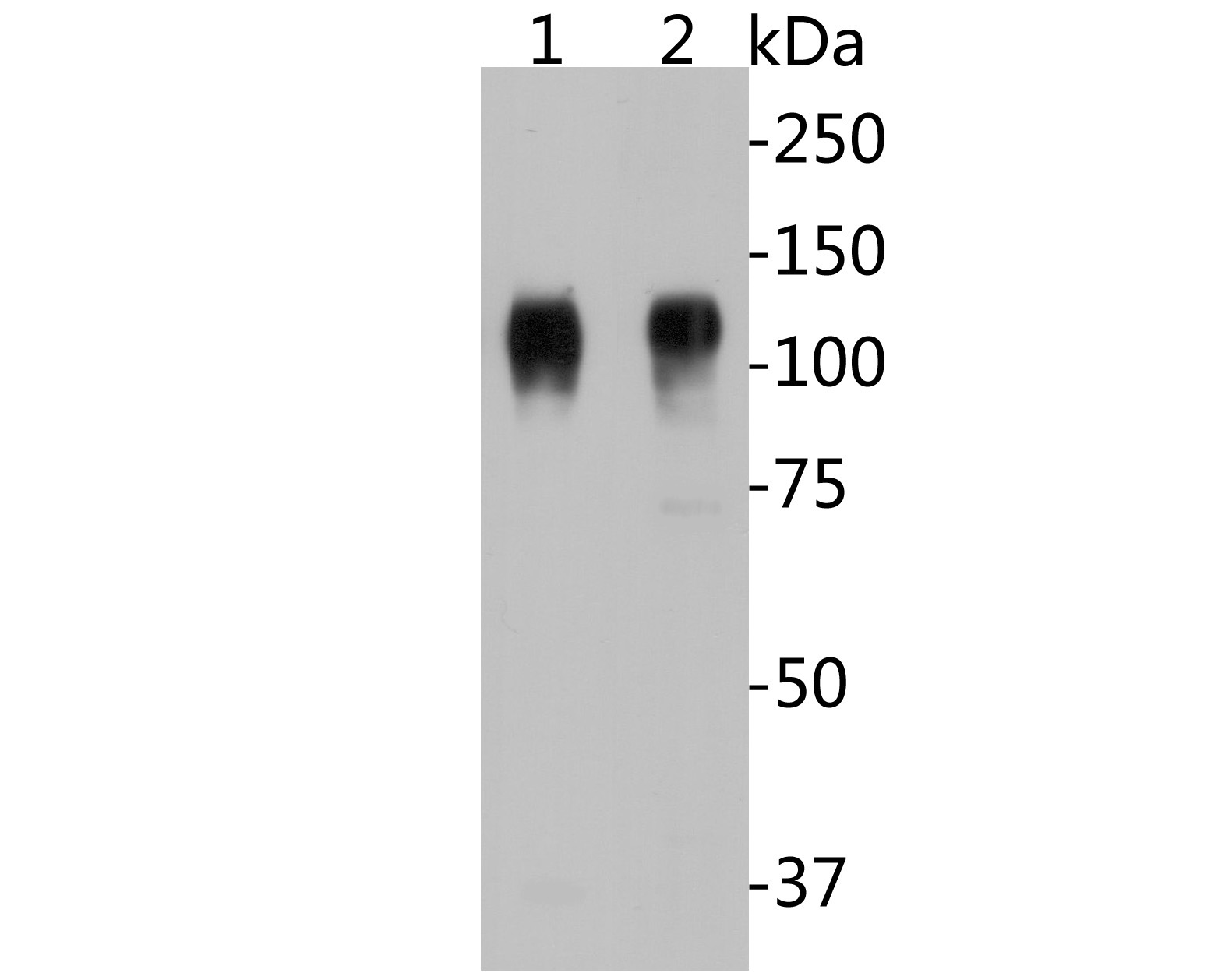 Fig1:; Western blot analysis of CD68 on different lysates. Proteins were transferred to a PVDF membrane and blocked with 5% BSA in PBS for 1 hour at room temperature. The primary antibody ( 1/500) was used in 5% BSA at room temperature for 2 hours. Goat Anti-Mouse IgG - HRP Secondary Antibody (HA1001) at 1:5,000 dilution was used for 1 hour at room temperature.; Positive control:; Lane 1: A431 cell lysate; Lane 2: THP-1 cell lysate