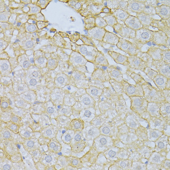 Immunohistochemistry - PLA2R1 Polyclonal Antibody 
