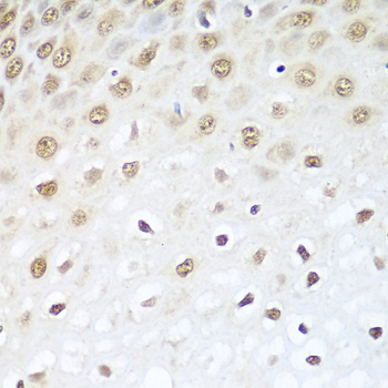 Immunohistochemistry - BCAS2 Polyclonal Antibody 