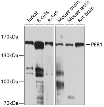 Western blot - PER1 Polyclonal Antibody 