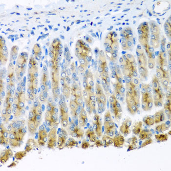 Immunohistochemistry - UQCR10 Polyclonal Antibody 