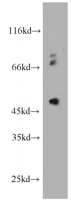 HeLa cells were subjected to SDS PAGE followed by western blot with Catalog No:113894(PIGM antibody) at dilution of 1:800