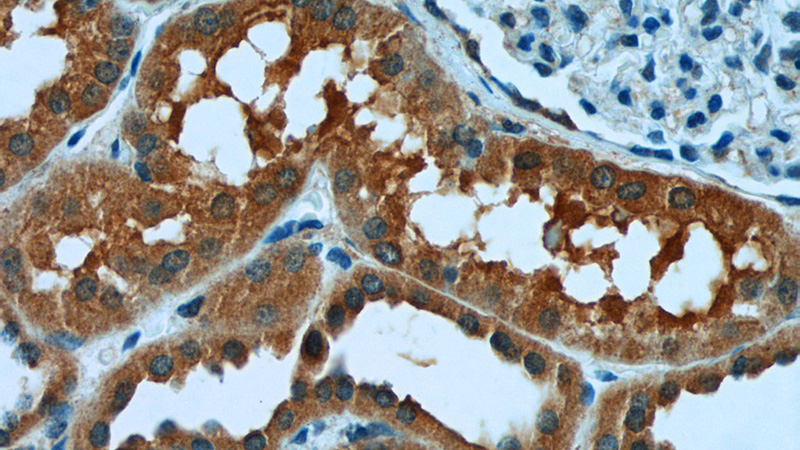 Immunohistochemistry of paraffin-embedded human kidney tissue slide using Catalog No:116685(USP46 Antibody) at dilution of 1:50 (under 40x lens)