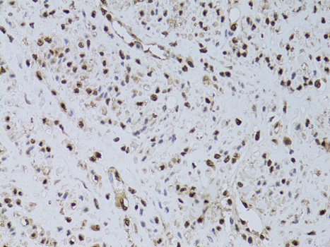 Immunohistochemistry - HUS1 Polyclonal Antibody 