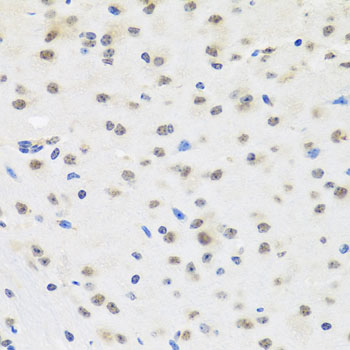 Immunohistochemistry - SAFB2 Polyclonal Antibody 
