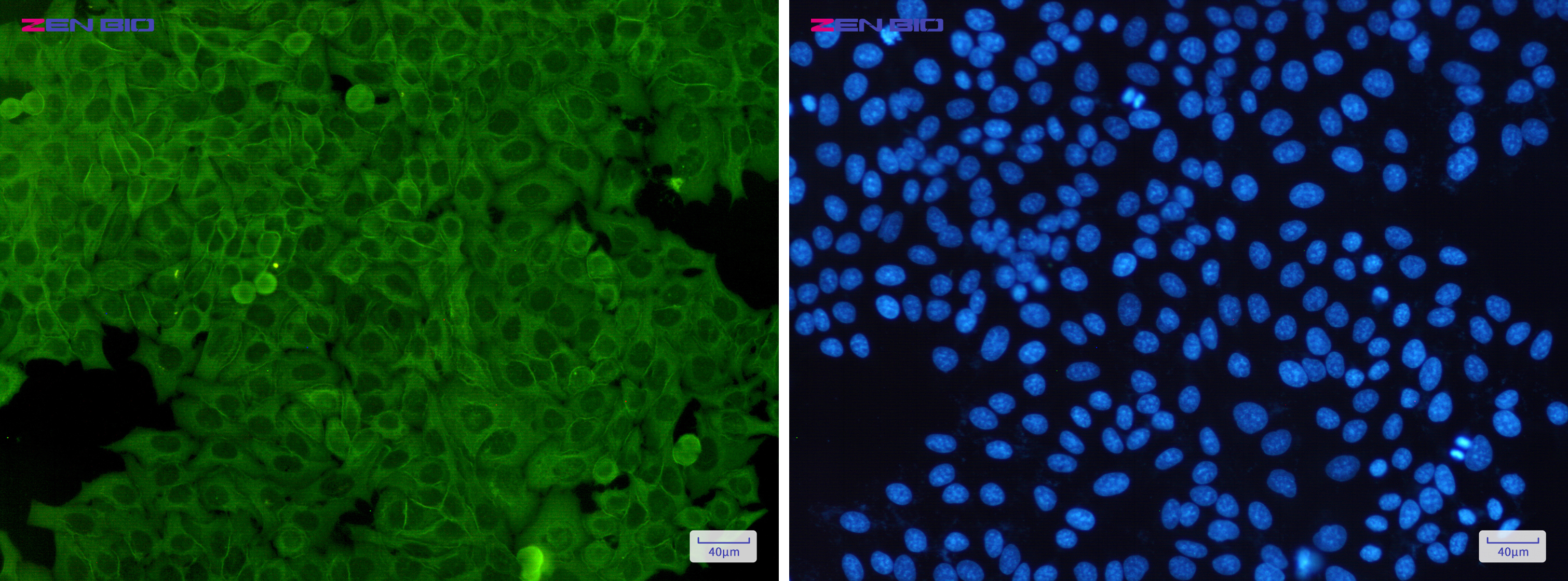 Immunocytochemistry of Annexin A2(green) in Hela cells using Annexin A2 Rabbit pAb at dilution 1/50, and DAPI(blue)