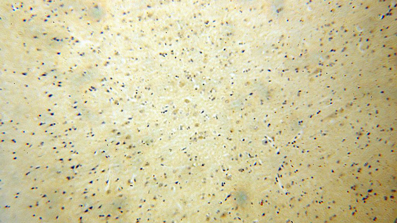 Immunohistochemical of paraffin-embedded human brain using Catalog No:113898(PIGT antibody) at dilution of 1:100 (under 10x lens)