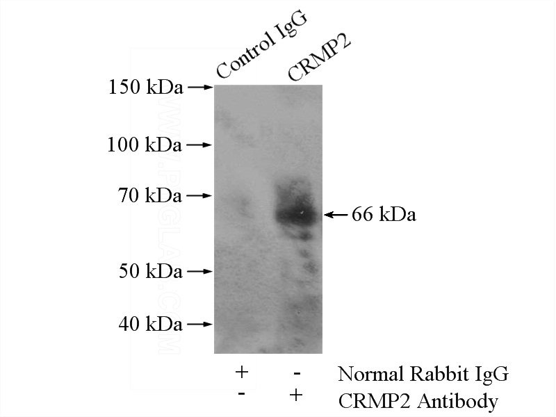 IP Result of anti-DPYSL2 (IP:Catalog No:109571, 4ug; Detection:Catalog No:109571 1:300) with mouse brain tissue lysate 3200ug.