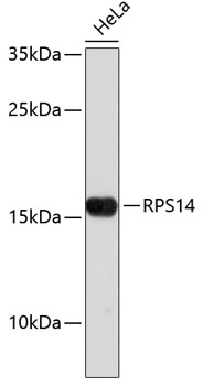 Western blot - RPS14 Polyclonal Antibody 
