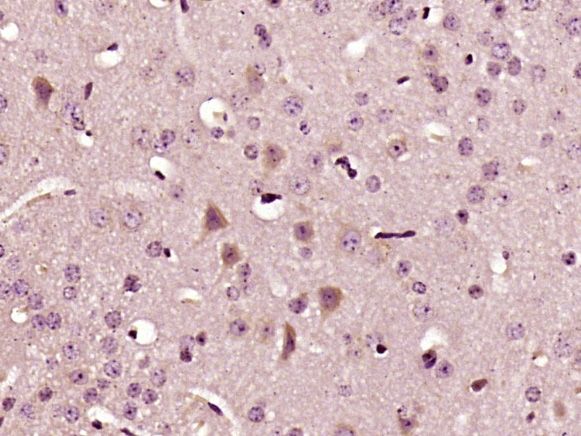 Fig2: Paraformaldehyde-fixed, paraffin embedded (Mouse brain); Antigen retrieval by boiling in sodium citrate buffer (pH6.0) for 15min; Block endogenous peroxidase by 3% hydrogen peroxide for 20 minutes; Blocking buffer (normal goat serum) at 37℃ for 30min; Antibody incubation with (IL22) Polyclonal Antibody, Unconjugated at 1:400 overnight at 4℃, followed by a conjugated secondary antibody (sp-0023) for 20 minutes and DAB staining.