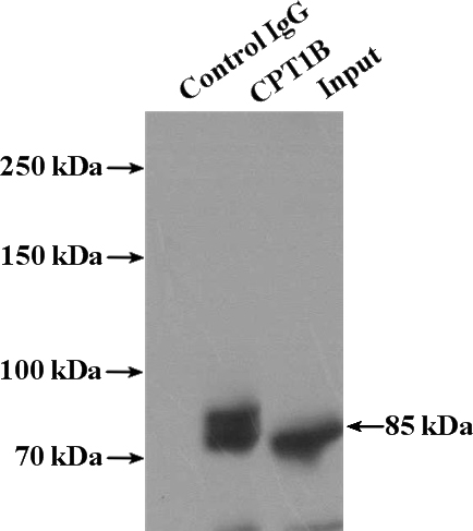 IP Result of anti-CPT1B (IP:Catalog No:109531, 4ug; Detection:Catalog No:109531 1:600) with mouse skeletal muscle tissue lysate 2200ug.