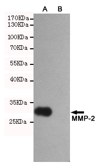 Western blot analysis of extracts from CHO-K1 (B) and CHO-K1 transfected by MMP-2 fragment(A) cell lysates using MMP-2 mouse mAb (1:2000 diluted). Predicted band size:30KDa. Observed band size:30KDa.
