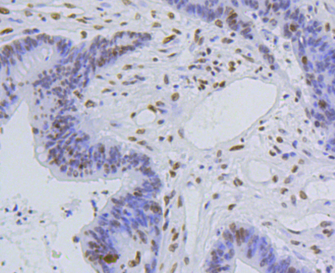 Immunohistochemistry - Acetyl-Histone H4-K5 mAb 