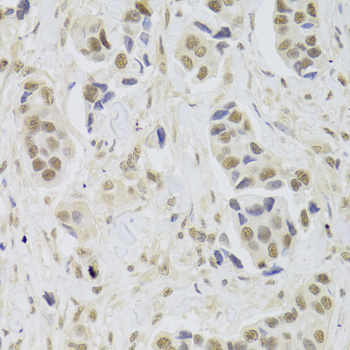 Immunohistochemistry - UBE3C Polyclonal Antibody 