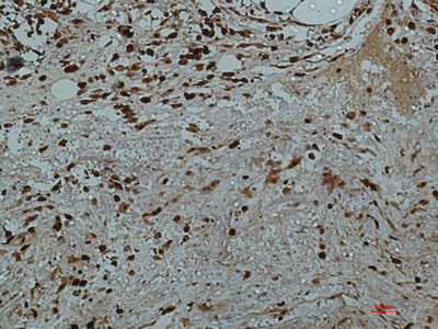 Immunohistochemical analysis of paraffin-embedded human-colon2 using antibody diluted at 1:50.