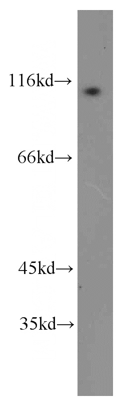 HL-60 cells were subjected to SDS PAGE followed by western blot with Catalog No:108177(ARHGAP4 antibody) at dilution of 1:1000