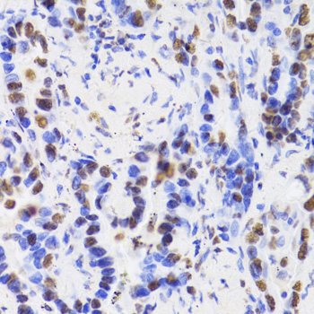 Immunohistochemistry - HDGF Polyclonal Antibody 