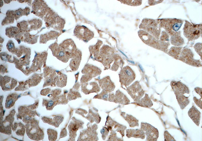 Immunohistochemistry of paraffin-embedded human heart slide using Catalog No:116320(TRIM54 Antibody) at dilution of 1:50