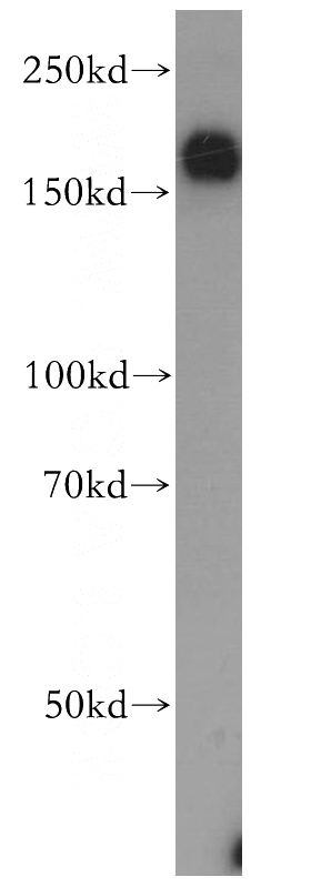 HeLa cells were subjected to SDS PAGE followed by western blot with Catalog No:116056(TSP1 antibody) at dilution of 1:300