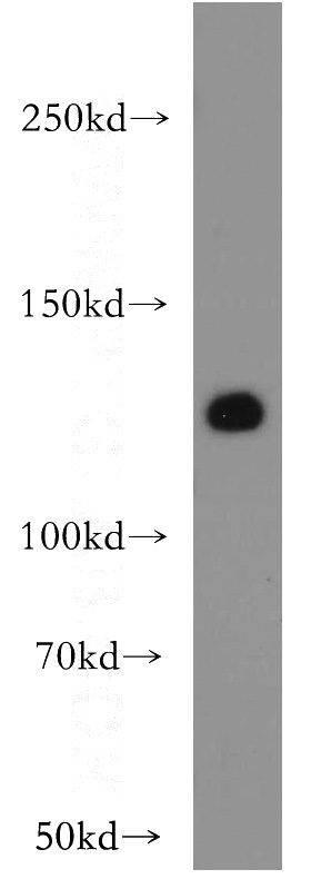 mouse spleen tissue were subjected to SDS PAGE followed by western blot with Catalog No:116740(FLT4 antibody) at dilution of 1:300