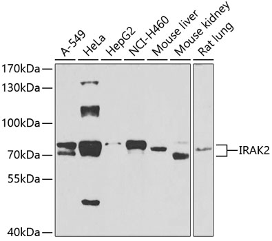 Western blot - IRAK2 Polyclonal Antibody 