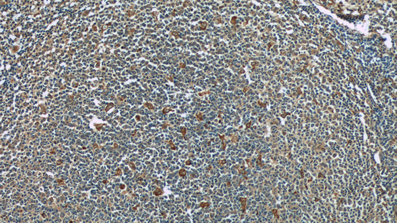 Immunohistochemistry of paraffin-embedded human tonsillitis tissue slide using Catalog No:109078(CCR7 Antibody) at dilution of 1:50 (under 10x lens)