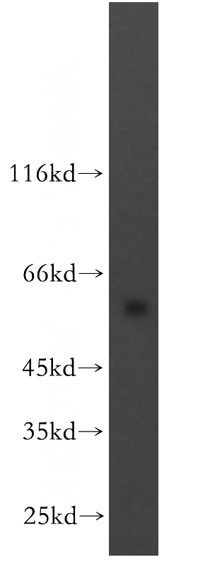 human brain tissue were subjected to SDS PAGE followed by western blot with Catalog No:111577(HYAL3 antibody) at dilution of 1:500