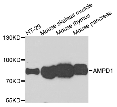 Western blot - AMPD1 Polyclonal Antibody 
