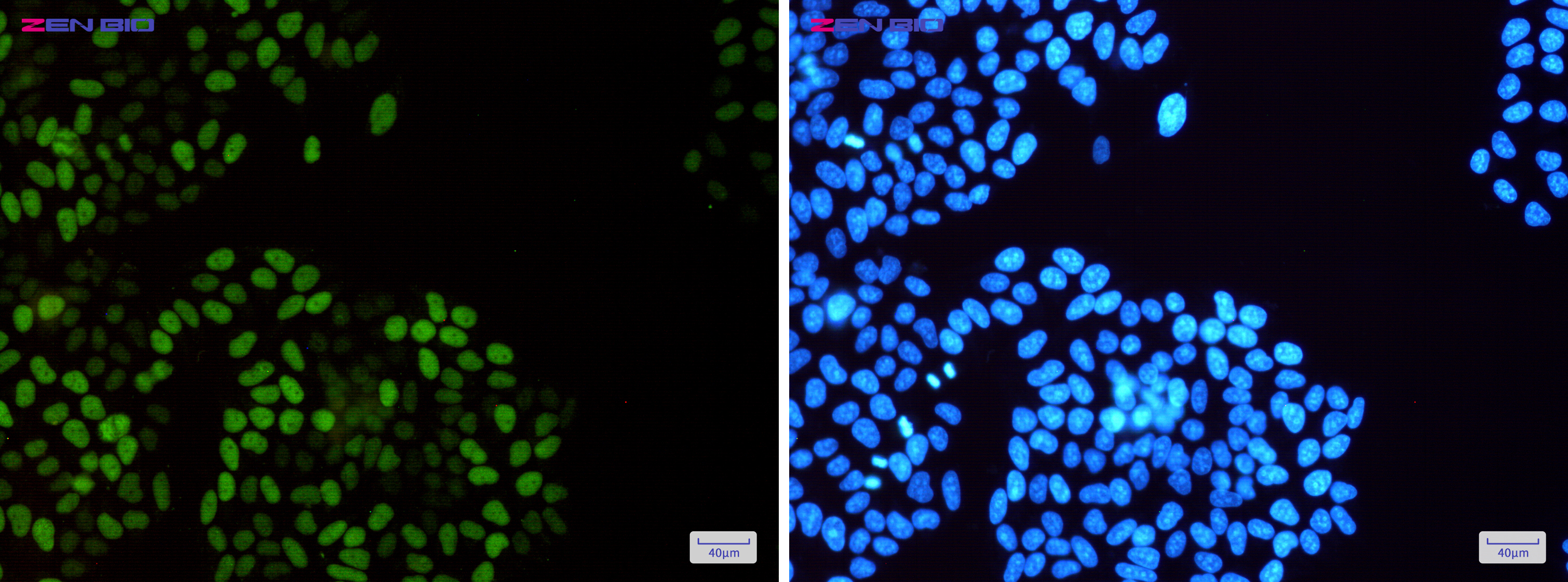 Immunocytochemistry of MCM2 (Phospho-Ser108)(green) in Hela cells using MCM2 (Phospho-Ser108) Rabbit mAb at dilution 1/50, and DAPI(blue)