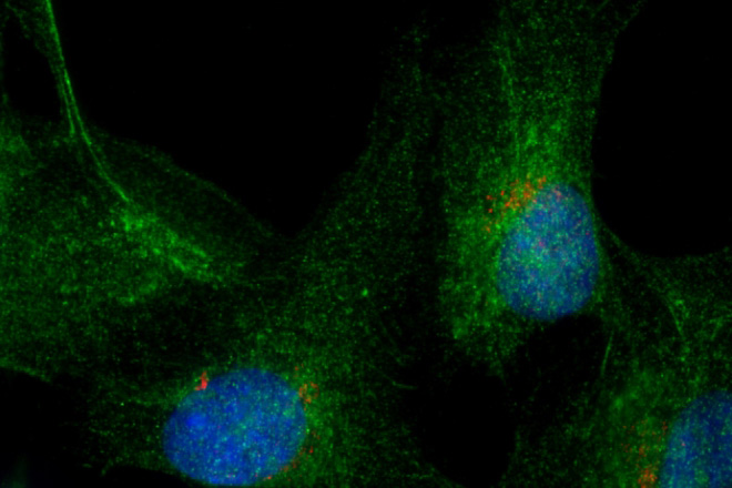 IF result of RAB9B antibody (Catalog No:114465, 1:200) detected with PFA fixed HeLa cells. Greem: RAB9B antibody stains late endosomes. Red, Golgi stain.