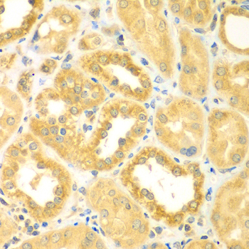 Immunohistochemistry - PDE4DIP Polyclonal Antibody 