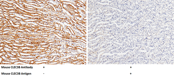 CLEC3B / Tetranectin Antibody, Rabbit PAb, Antigen Affinity Purified, Immunohistochemistry